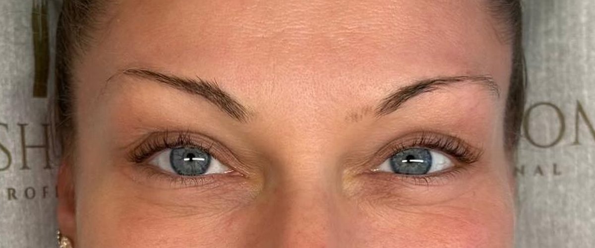 Vorher: Wimpern