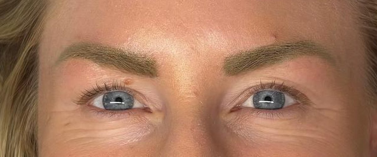 Vorher: Wimpern